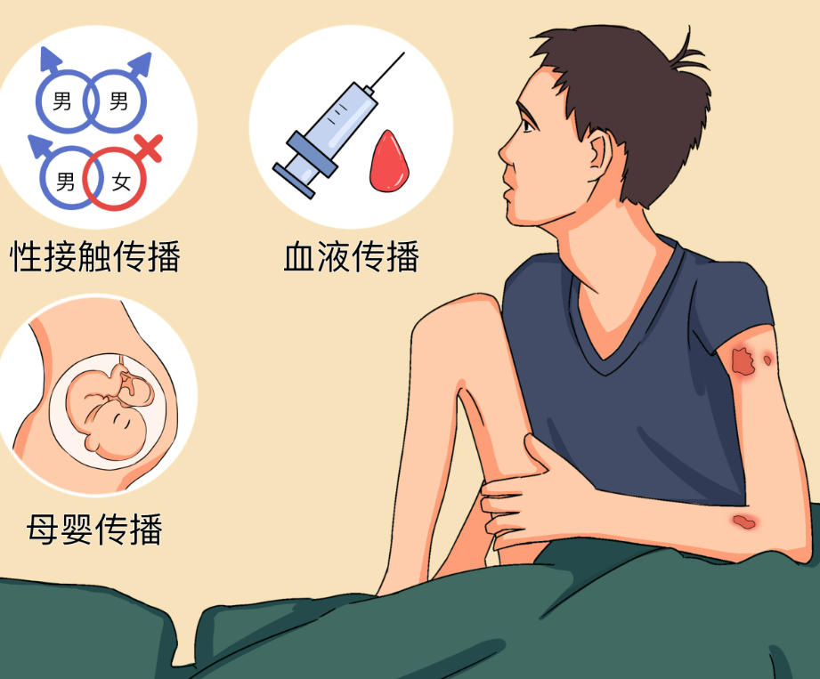 X行为后第二天出现症状，是不是感染艾滋病了？