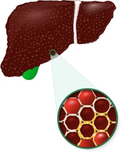 【双语】别信！这些“乙肝说”不可信！ ئىشەنمەڭ! بۇ «ب  تىپلىق جىگەر ياللۇغى» توغىرسىدىكى ئۆسەك سۆزلە ئىشەنچلىك ئەمەس!