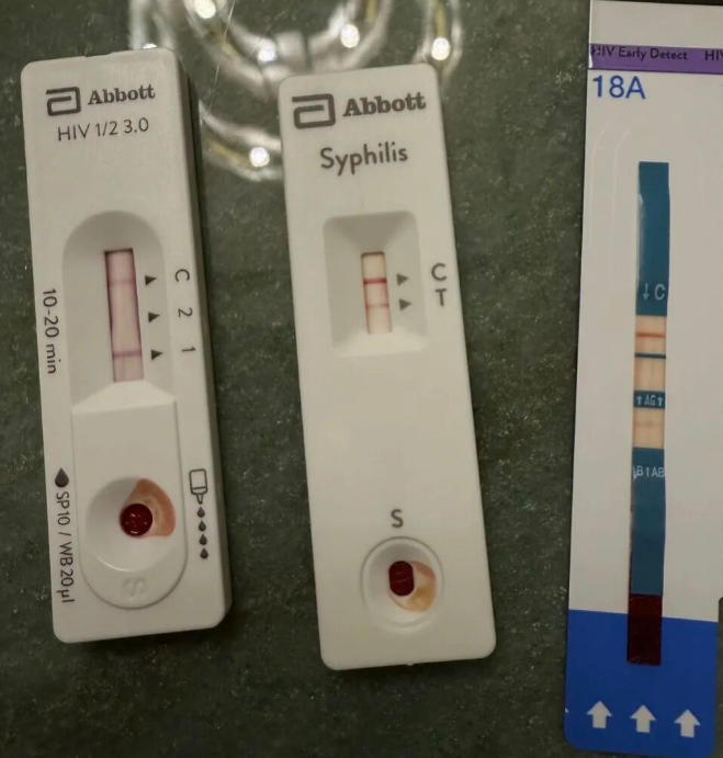 “怀疑自己感染了艾滋病，一直不敢去检测？”