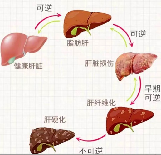 健康科普 | 一旦感染乙肝就被终生标记了吗？ 