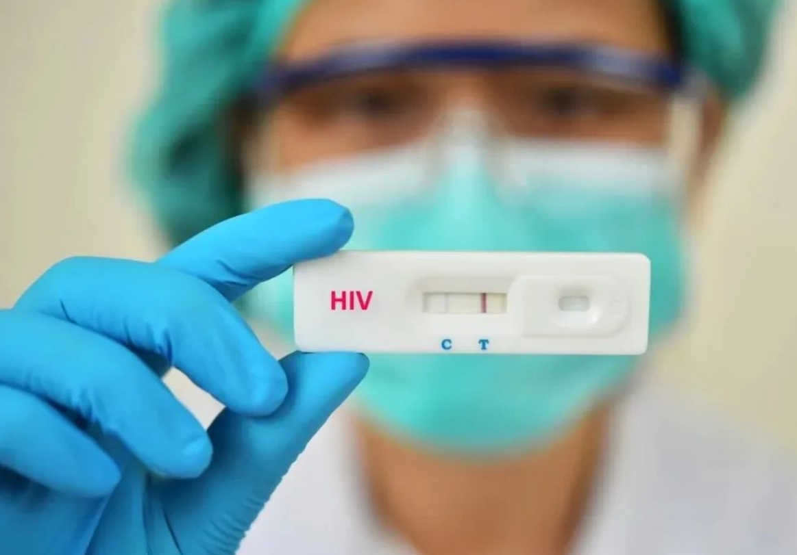 意大利研究：约 40% HIV 阴性者选择接受 PrEP，而未接受者中有 17.7% 被诊断至少一种性传播感染