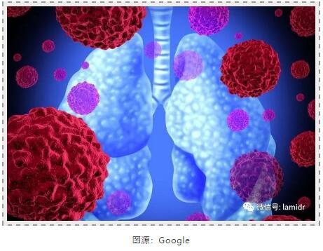 【双语】HIV感染者的头号敌人？ ئەيدىزدىن يۇقۇملانغۇچىنىڭ بىرىنچى دەرىجىلىك دۈشمىنى