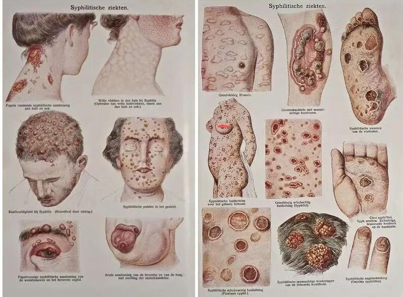 自己感染了梅毒，家人会有危险吗？