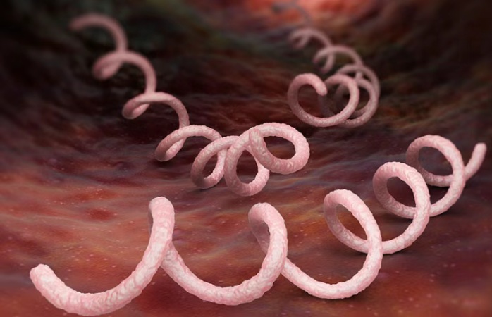 【双语】当怀疑感染梅毒时需要做哪些检查？ سىفلىس بىلەن يۇقۇملانغان دەپ گۇمانلانغاندا قانداق تەكشۈرۈشلەرنى قىلىش كېرەك  