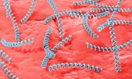 【双语】梅毒到底是什么病？一文读懂！   سىفلىس زادى قانداق كېسەل 