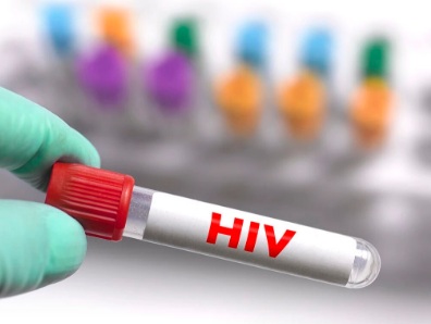 【双语】HIV 初筛有反应≠确诊：还要做确证？ ئەيدىز كېسىلى دەسلەپكى قەدەمدىكى رېئاكسىيە ≠ دىئاگنوز قويۇش ئەمەس: يەنە جەزى